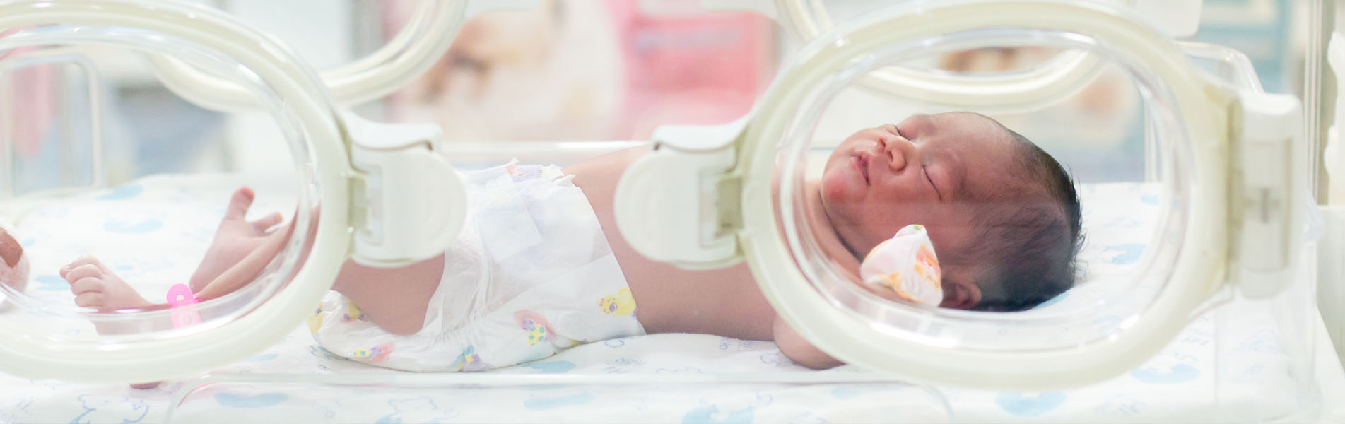 Signs of Cerebral Palsy in Newborns